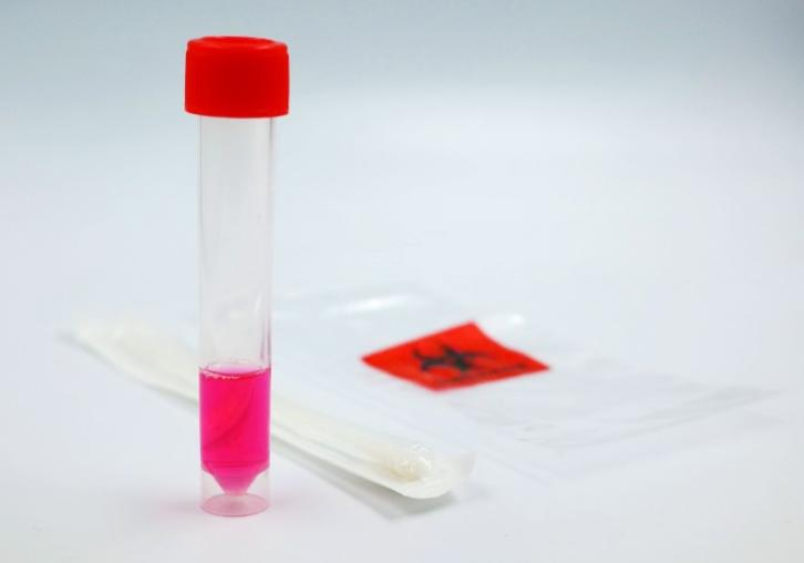 一次性使用病毒采样管 一次性使用病毒采样管