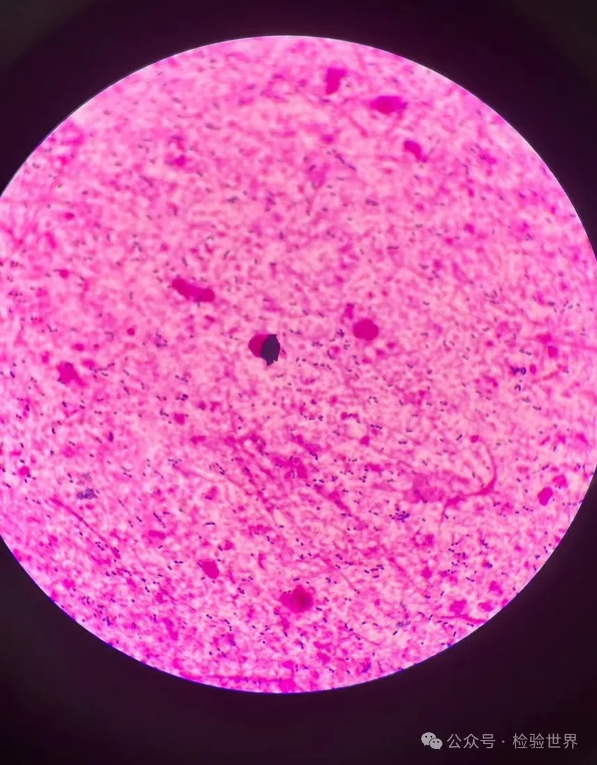 肺炎链球菌形态与染色