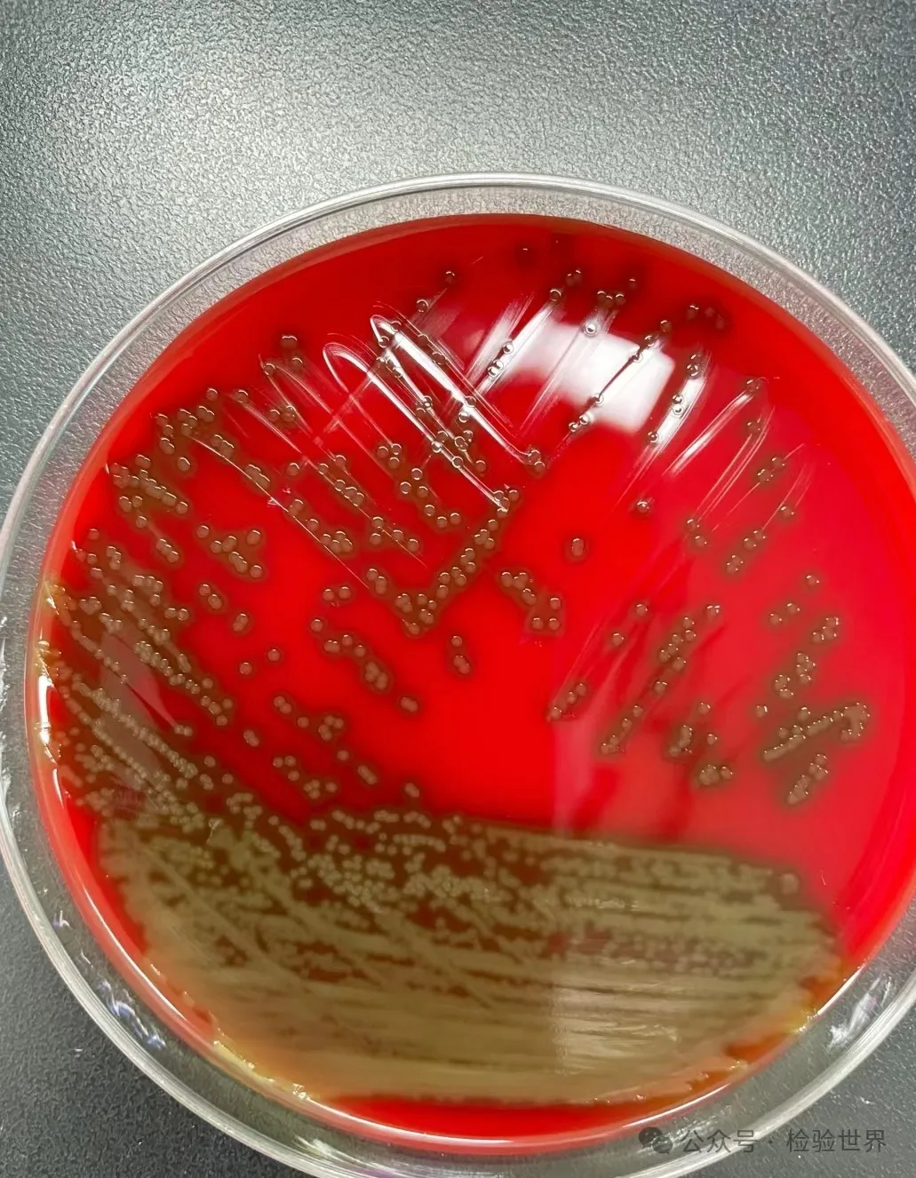 肺炎链球菌培养特性