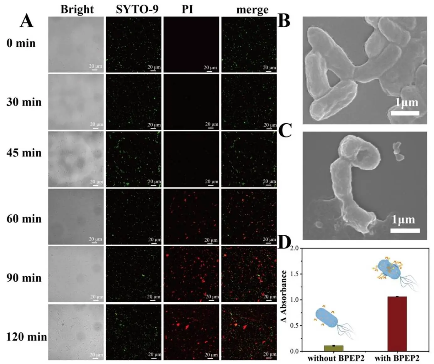 观察噬菌体感染大肠杆菌过程及 β - 半乳糖苷酶释放差异
