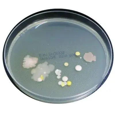 图 4-培养皿-不规则簇状生长 