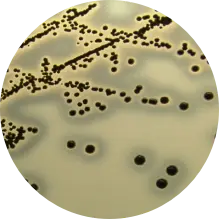  BP培养基上的金黄色葡萄球菌