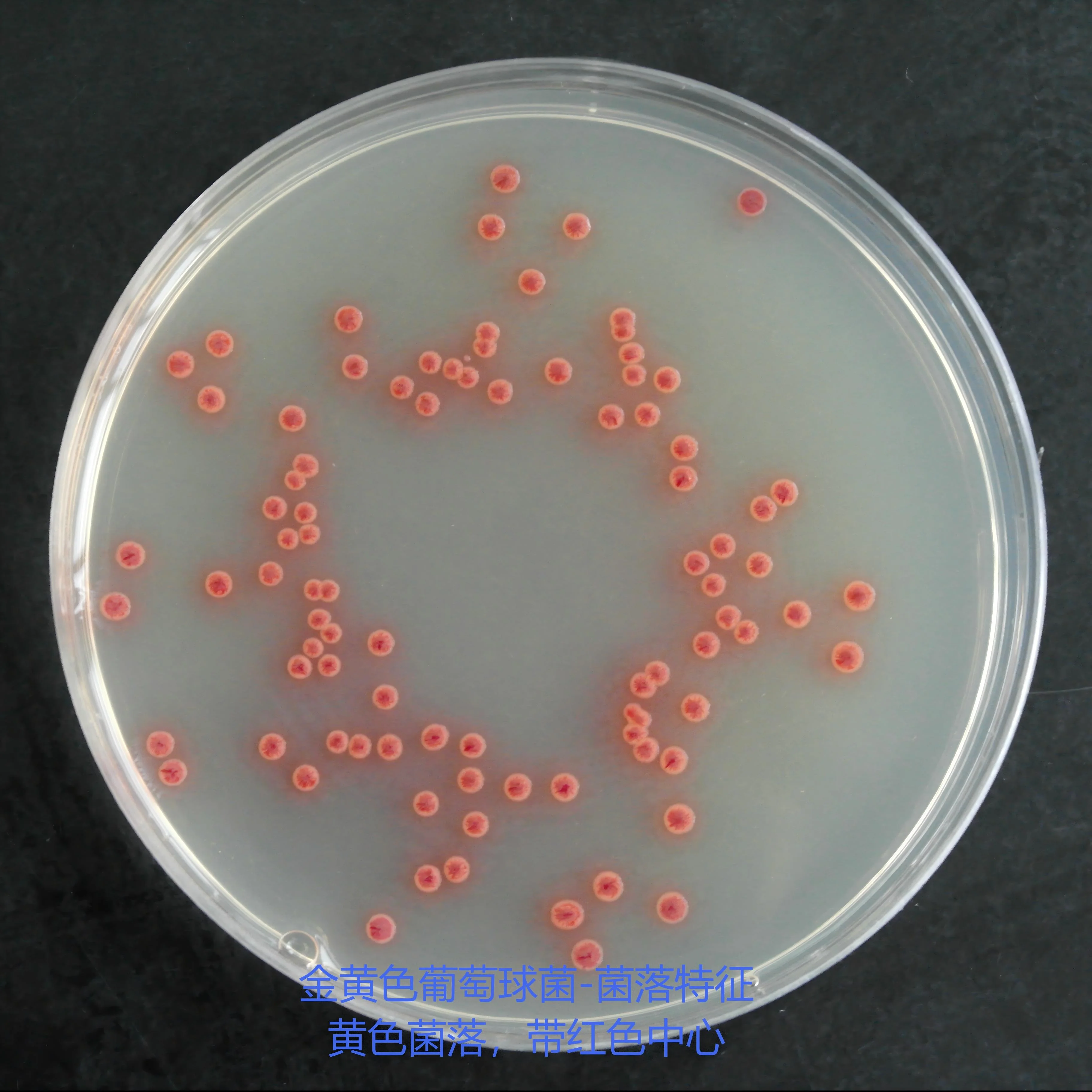 金黄色葡萄球菌-菌落特征：黄色菌落，带红色中心