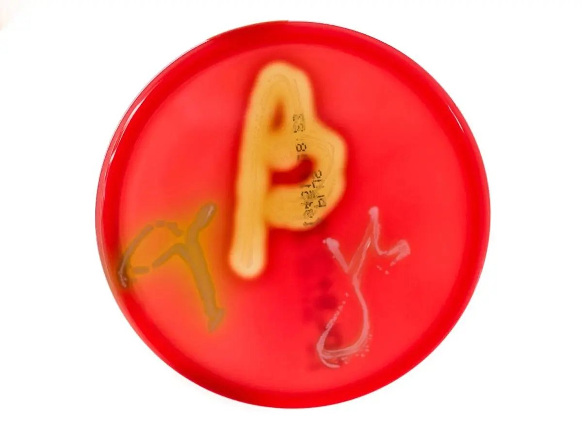 血琼脂培养显示的 α（左）、β（中）和 γ（右）溶血