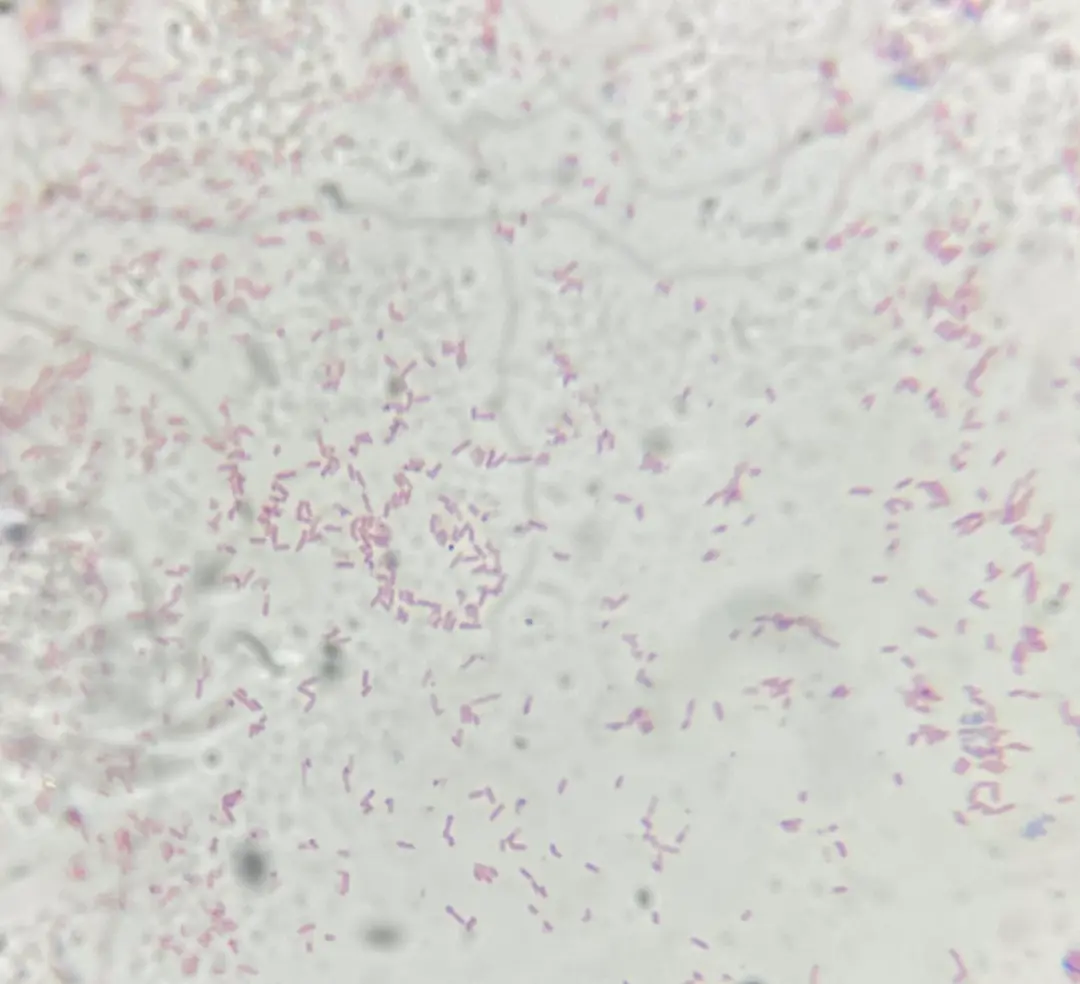 大肠埃希氏菌（革兰氏阴性菌）的镜检图片