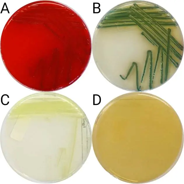 菌株4在不同琼脂平板上的形态学，含亚米佩南（A： M-PA-C;B：克罗玛加尔;C：CN琼脂;D：mZ-琼脂）