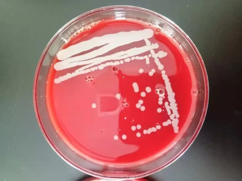 自制的血平板有时会出现气泡，坑洼凹凸不平的现象