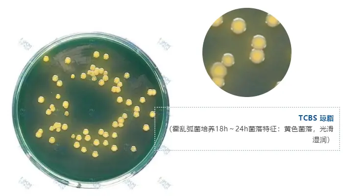 TCBS 琼脂（霍乱弧菌培养18h～24h菌落特征：黄色菌落，光滑湿润）