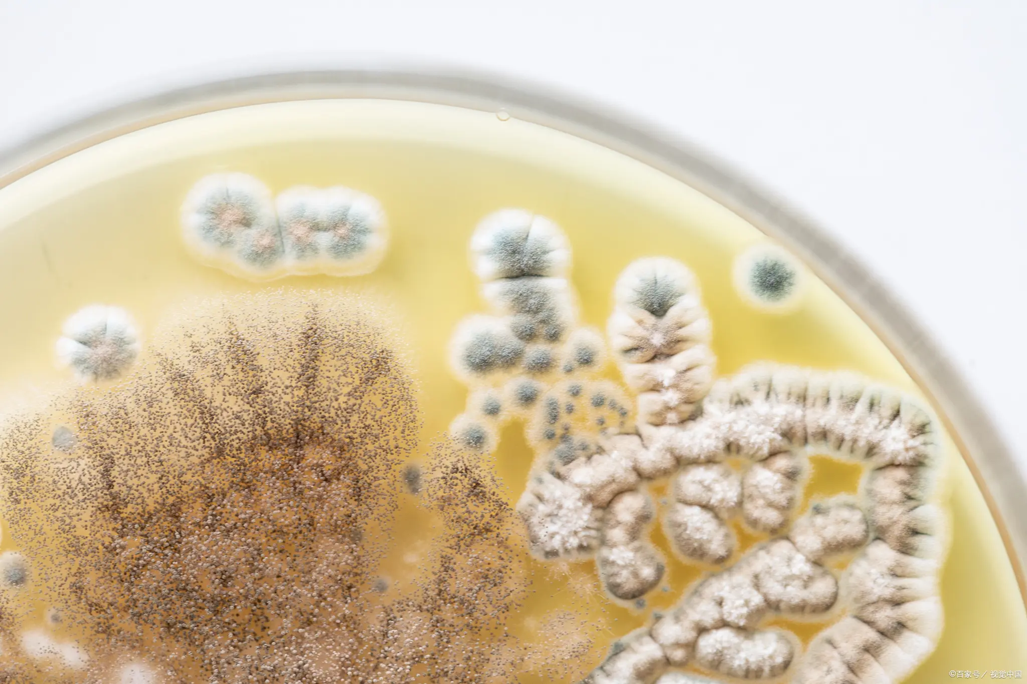 霉菌酵母菌检验常见问题