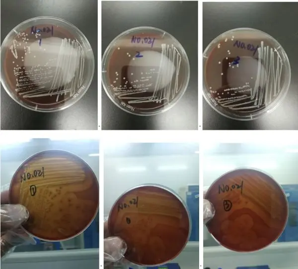 血平板（溶血观察）