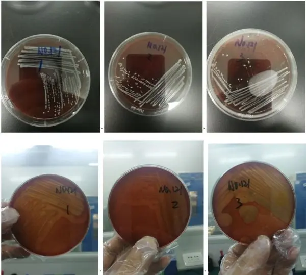 血平板（溶血观察）