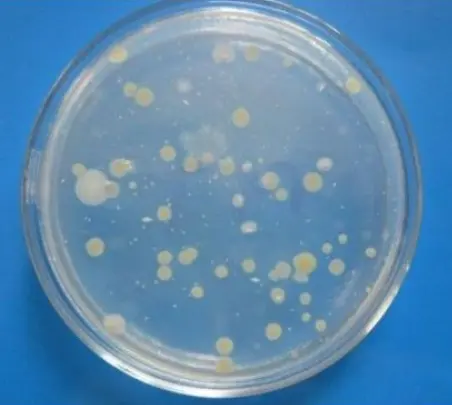 菌落计数及计算