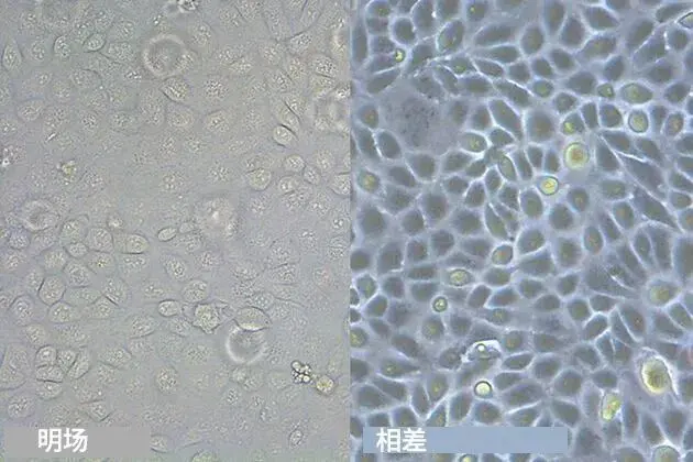 较狗肾脏细胞在明场照明和相差图像中的显示效果