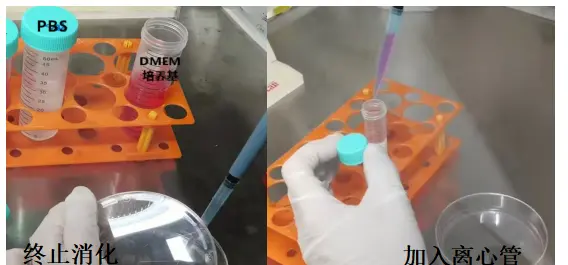 1-2min后，用含10%血清的DMEM培养基终止