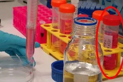 轻柔地冲洗培养皿