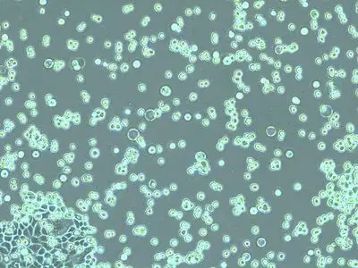 分离出的细胞应呈圆形并在胰蛋白酶溶液中自由漂浮