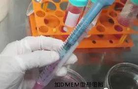弃上清，加DMEM培养基重悬