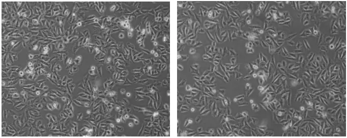 细胞正常生长形态
