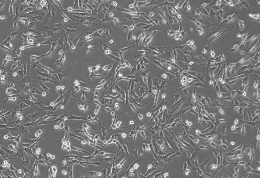 人宫颈癌（Hela）细胞