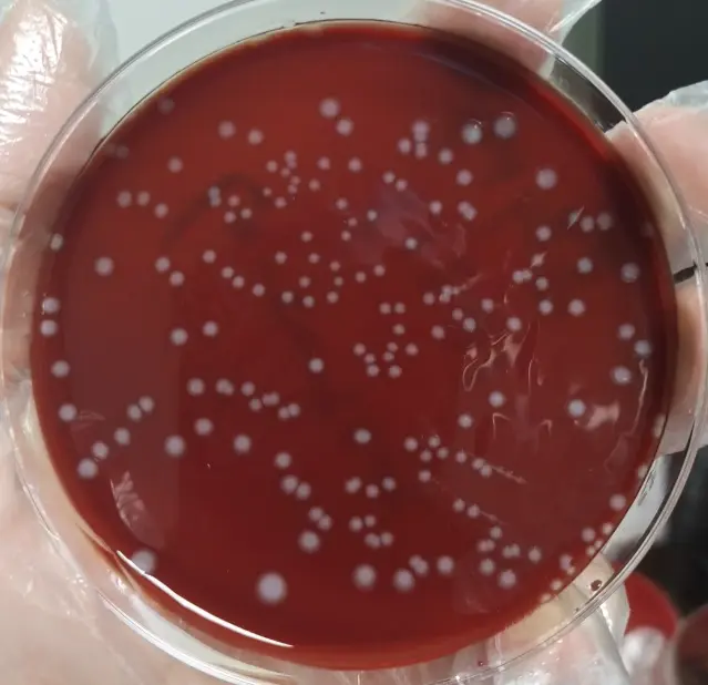 李斯特菌（Listeria）