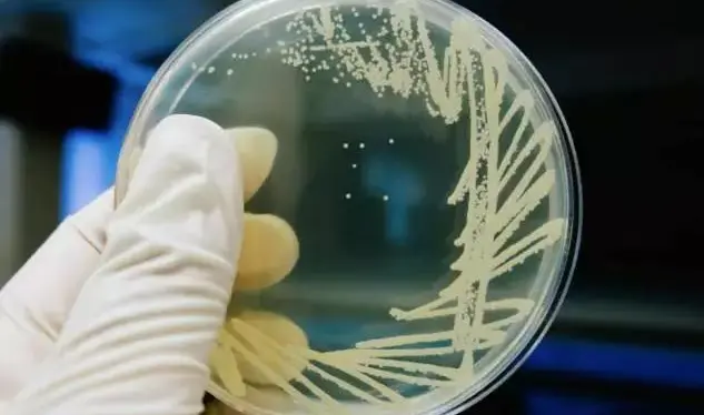 乳糖发酵鉴别平板