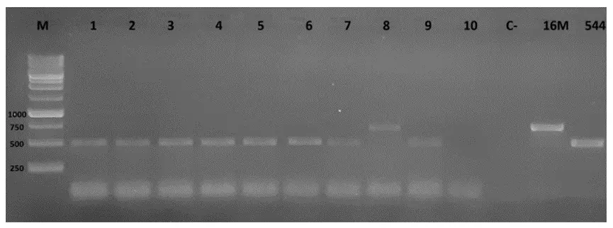 生牛乳样本PCR扩增产物1%琼脂糖凝胶电泳（AMOS PCR显示731bp条带）